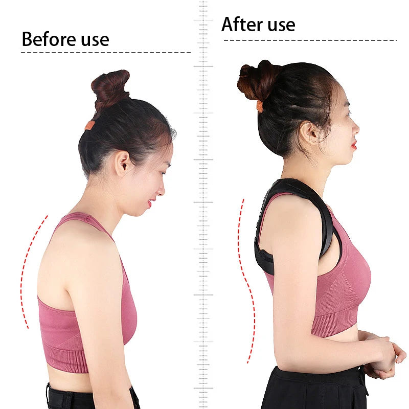 Serenity Luster Posture Corrector - Serenity Luster