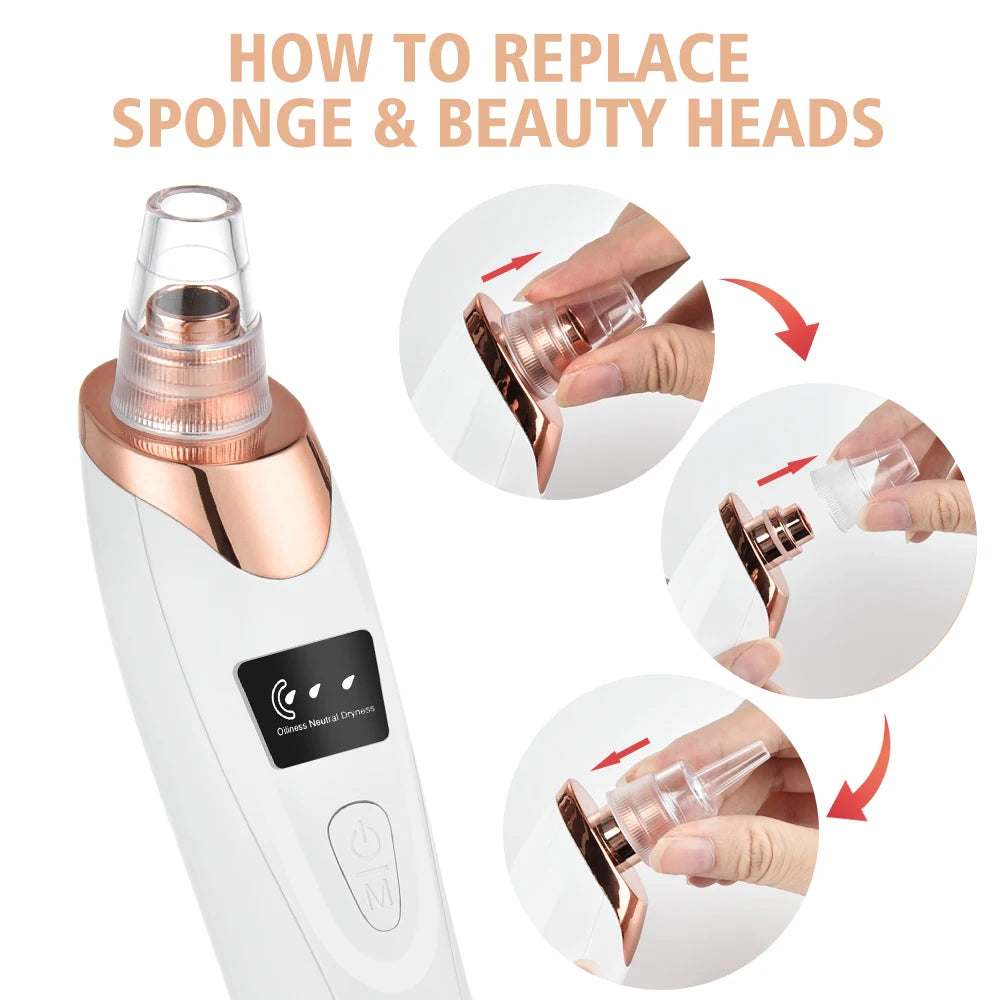 Serenity Luster Vacuum Blackhead Remover - Serenity Luster