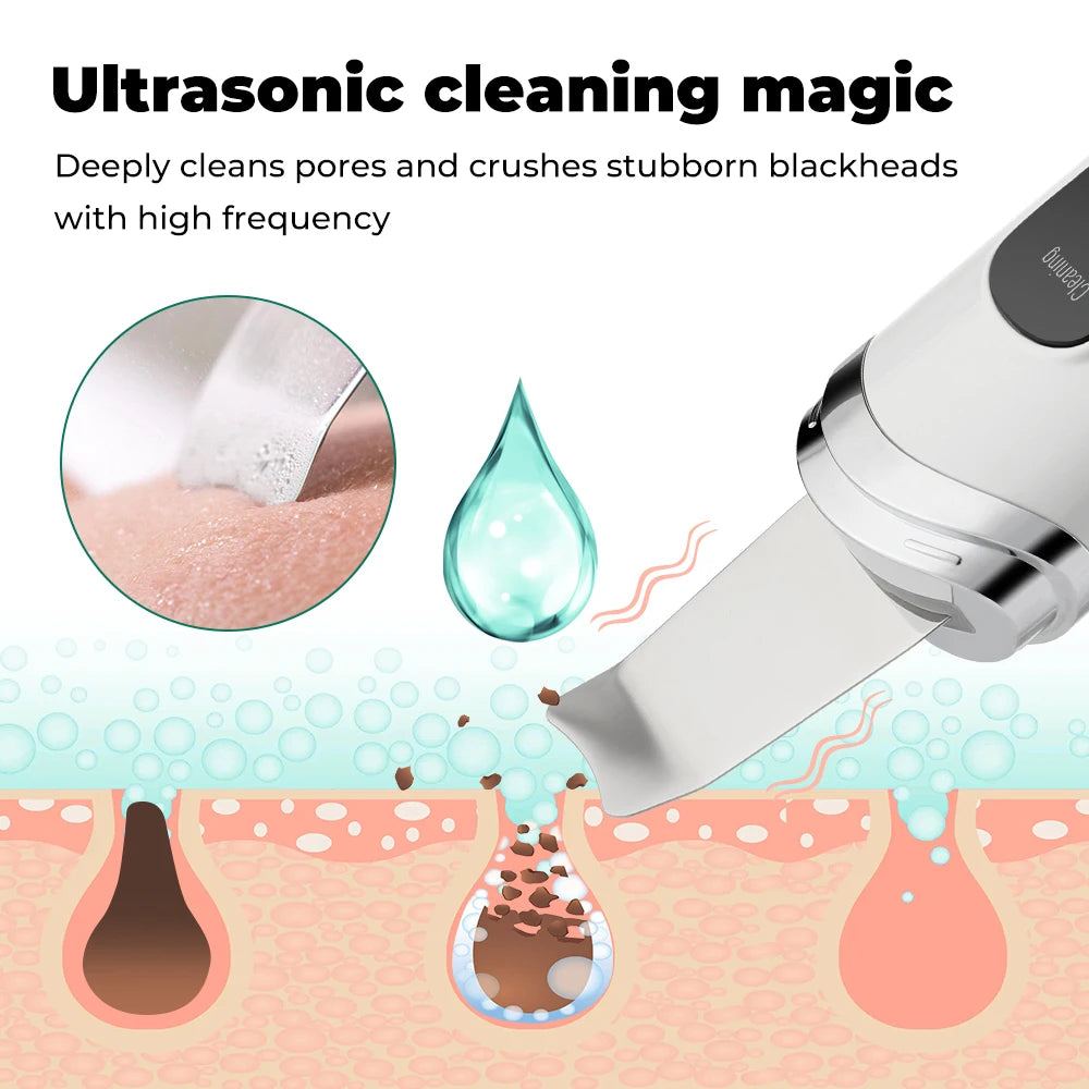 Serenity Luster Ultrasonic Skin Scrubber - Serenity Luster